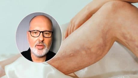 Alberto Sanagustín, médico de familia: “Cuidado con las vitaminas que se anuncian como si fueran un desatascador mágico para las venas”