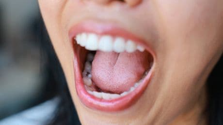 Scientists just mapped your tongue. It may be the key to helping you lose weight