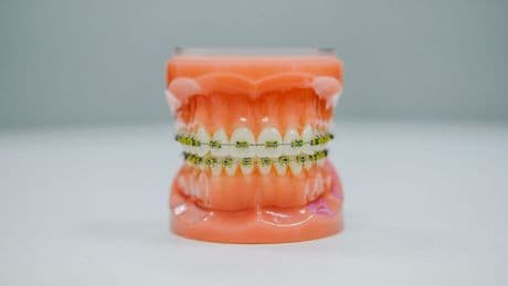 Nos ancêtres avaient les dents droites et bien alignées, alors pourquoi nos chicots sont-ils si pourris?