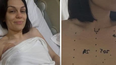Jessie J shares tearful update after undergoing breast cancer surgery