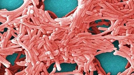 A Legionnaires’ disease outbreak has killed someone in Ontario. Here’s what you need to know