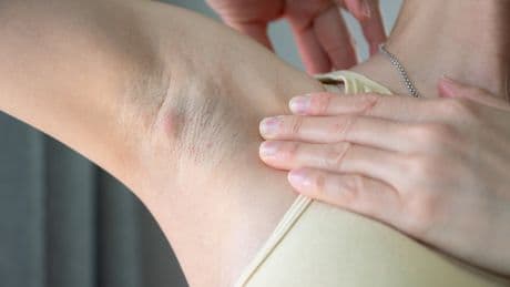 6 Symptoms A Lymphoma Doctor Would Never, Ever Ignore