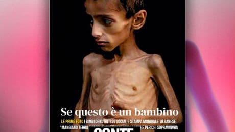 "Sei uno sciacallo". Conte nella bufera: la vergogna sulla foto del bimbo scheletrico