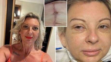 I spent £7k on ‘mummy makeover’ surgery but I look better fat – it feels like I’m ripped in HALF from painful stitches