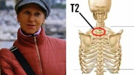 Liliana Resinovich, la famiglia non crede alla frattura durante l'autopsia: «Depistaggio, è stata uccisa»