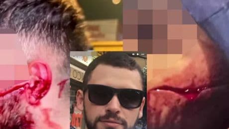 Gangster who sparked Scotland's violent drug war pictured after brutal revenge slashing