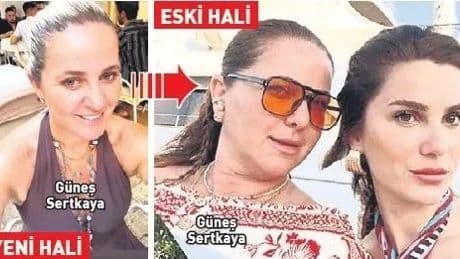 BÜLENT CANKURT / Estetikli kayınvalide ortaya çıktı 10 yaş gençleşmiş