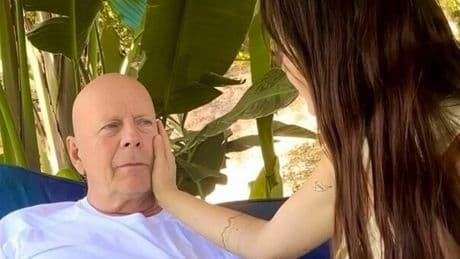 Bruce Willis, la moglie Emma Heming: «Sta bene, ma il suo cervello sta cedendo». Cosa è la demenza frontotemporale