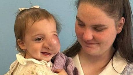 Little girl dies of cancer after doctors assume facial lump 'was caused by parents'