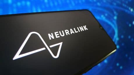 2 Toronto hospital patients get Elon Musk’s Neuralink implants in Canadian 1st