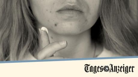 Fausses couches, graves malformations... Ce médicament contre l’acné aux conséquences dramatiques sur les nouveau-nés