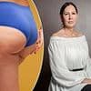 I tried the new 'safer' version of the Brazilian butt lift and it almost killed me. This is the vital advice anyone thinking of having the procedure needs to know