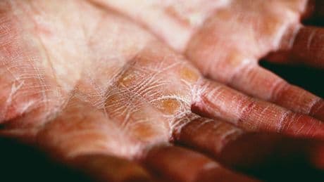 7 'Normal' Symptoms A Doctor Says You Should Never, Ever Ignore