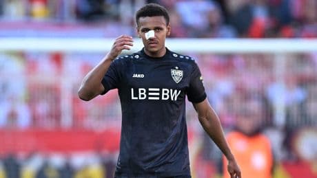 „Wenn man die Nase sieht …“ - VfB-Star droht Verletzungspause