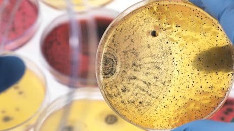 Tausende Tote in Deutschland, weil Antibiotika nicht mehr wirken
