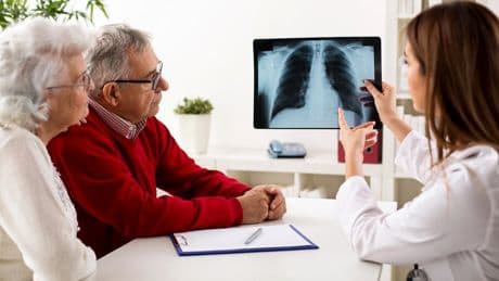 Never smoked? You could still be at risk of developing lung cancer, doctors warn