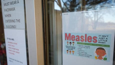 U.S. measles cases surpass 2019 count, while Missouri is latest state with an outbreak