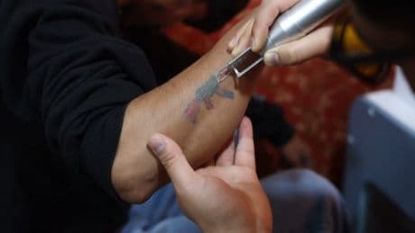 In Indian Kashmir, political tattoos face a cleansing campaign