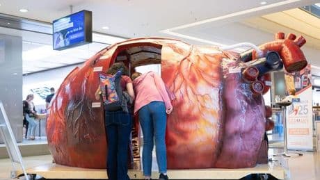 Gesellschaft: World Transplant Games – Kritik an Organspendepolitik