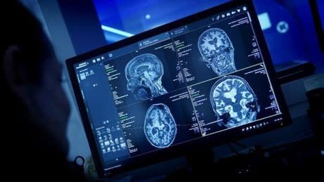 ¿Qué ocurre en tu cerebro cuando tu mente se queda en blanco?
