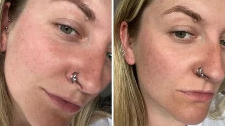 'L'Oreal's new eye bag remover got rid of my under-eye wrinkles in under 15 minutes – but with a catch'