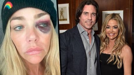 Einstweilige Verfügung gegen Ex-Mann! - Denise Richards übel zugerichtet