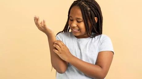 NHS warns parents of infection that makes children's skin 'feel like sandpaper'