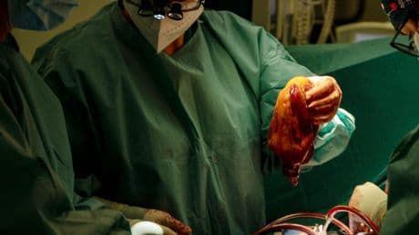 Medizin: Warum Spanier so viele Organe spenden