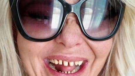 'I started one habit to avoid drinking too much and it cost me my teeth'