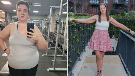 I lost half my weight on Ozempic — this is what happened to my body when I stopped