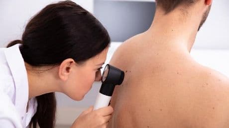 El cáncer de piel no deja de crecer en España: en 2025 se diagnosticarán más de 4.300 melanomas, el tumor más agresivo