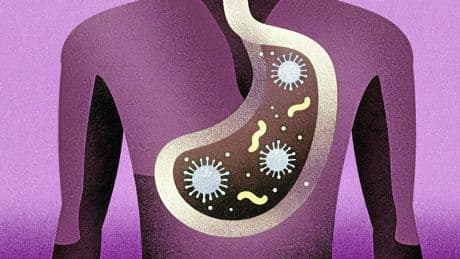 Cette bactérie pourrait être à l’origine de millions de cas de cancer de l’estomac dans les années à venir
