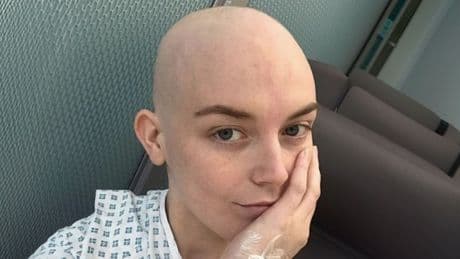 I had no idea my itchy skin meant I had a deadly disease
