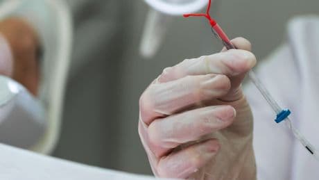 New Guidelines Address I.U.D. Insertion Pain and Offer Management Options