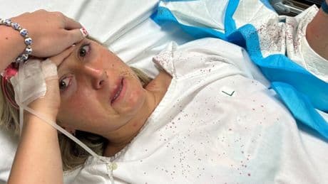 Brit mauled in water by SHARK watched ‘blood pour everywhere’ & thought she was going to die in horror holiday attack