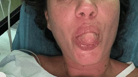 Ex-NBA star Danilo Gallinari’s pregnant wife bitten by shark in Puerto Rico