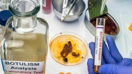 Botulino, sequestrati dai Nasi quasi 700 chili di conserve e succhi di frutta a rischio: ecco quali e dove