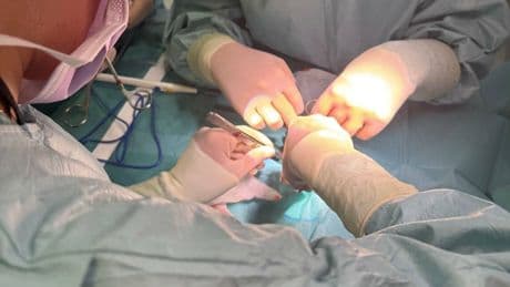 Cirujanos del 12 de Octubre corrigen una malformación en el corazón de un bebé prematuro en Burgos