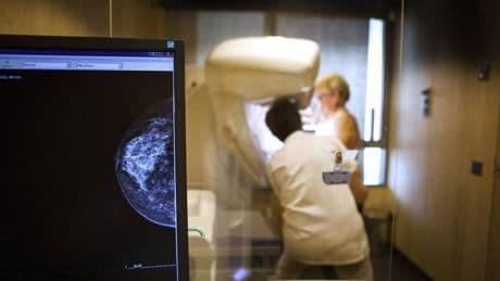 Así ha cambiado el cáncer de mama en España: cada año hay más casos pero son menos mortales