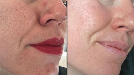 I Tried The Skin Care Dua Lipa 'Can't Live Without' – My Skin Cleared Up In 7 Days