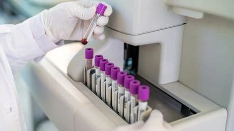 ¿Qué es la trombocitosis? Causas, primeros síntomas y tratamientos
