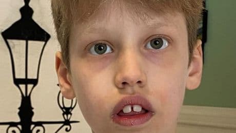 Bernard B. spurlos verschwunden: Polizei sucht autistischen Jungen