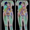 Biggest human imaging study scans 100,000th person