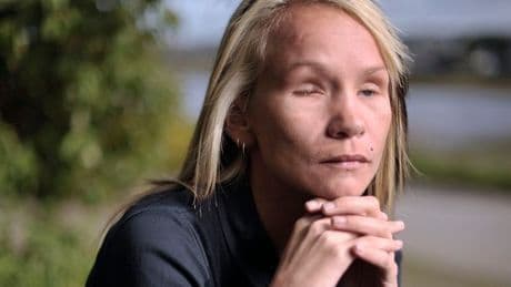 'My psychopath ex who gouged out my eyes is about to be let out - and he'll strike again'