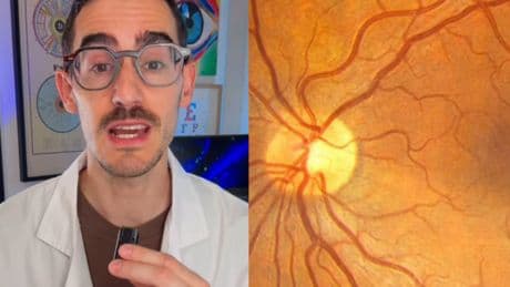 Alberto Villarroya, óptico optometrista: “Es posible diagnosticar TDHA tan solo con una fotografía de nuestros ojos”