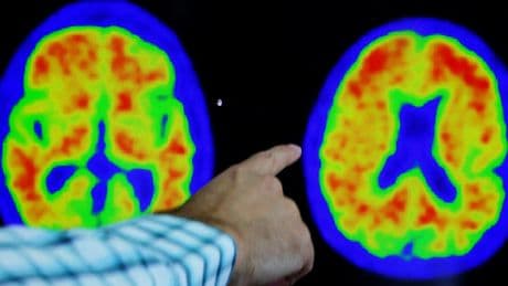 The prick of a finger sheds light on medical mystery