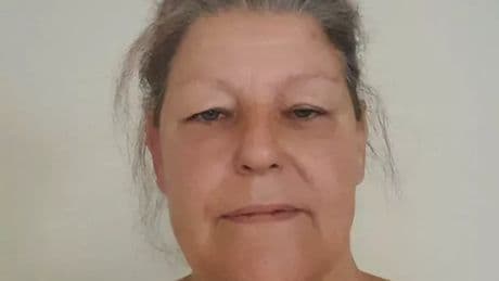 'I have nightmares over pocket bully dog attack which left me in hospital for days'
