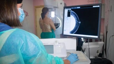 Éxito en el ensayo de un medicamento que mejora la supervivencia con cáncer de mama avanzado