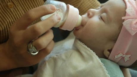 Yemek borusu olmadan doğan bebeğe 5 günlükken ameliyat yapıldı