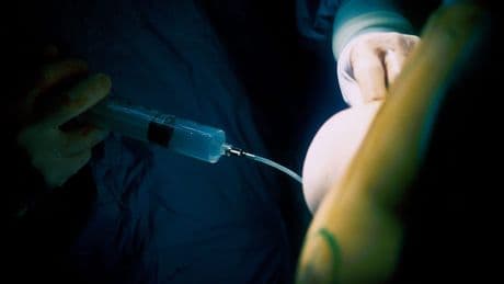 Pisa: Öl-Injektion in Brust endet tödlich – Ermittlungen laufen